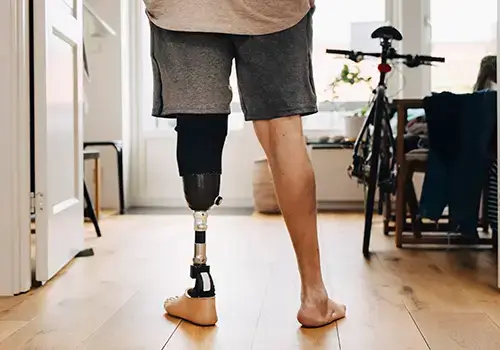 man standing on prosthetic leg